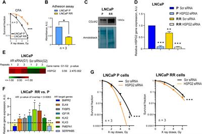 The extracellular matrix component perlecan/HSPG2 regulates radioresistance in prostate cancer cells